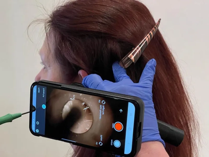 Earwax Cleaning Norwich